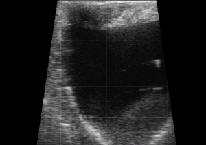 Bovine - Bladder and Ovary
