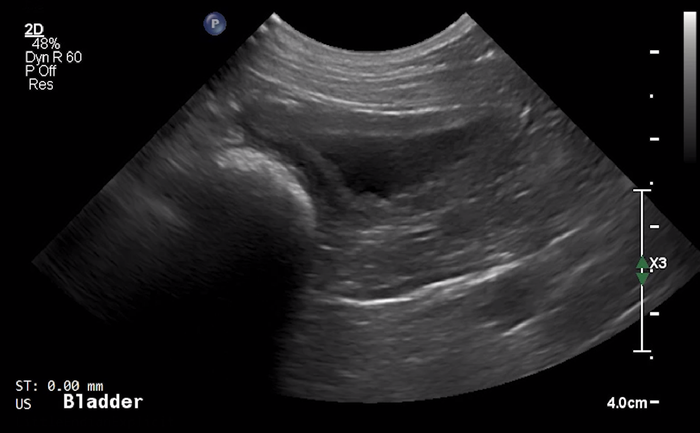 Canine Urinary Bladder (Longitudinal) 1 – NORMAL