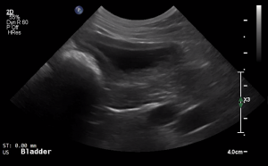 Canine Urinary Bladder (Longitudinal) 2 - NORMAL