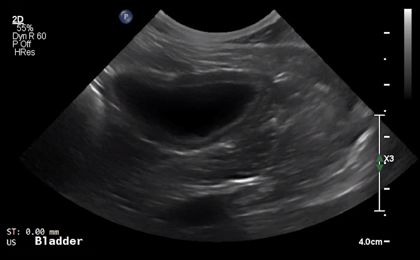 Canine Urinary Bladder (Transverse) – NORMAL