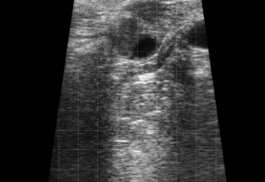 Bovine - Corpus Luteum