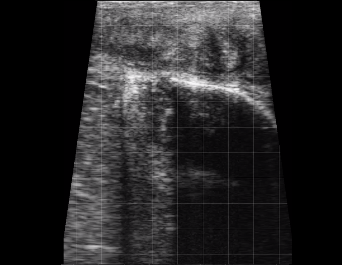 Bovine Cervix and Body (Normal)
