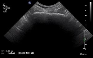 Canine Descending Colon (Long Axis) - NORMAL