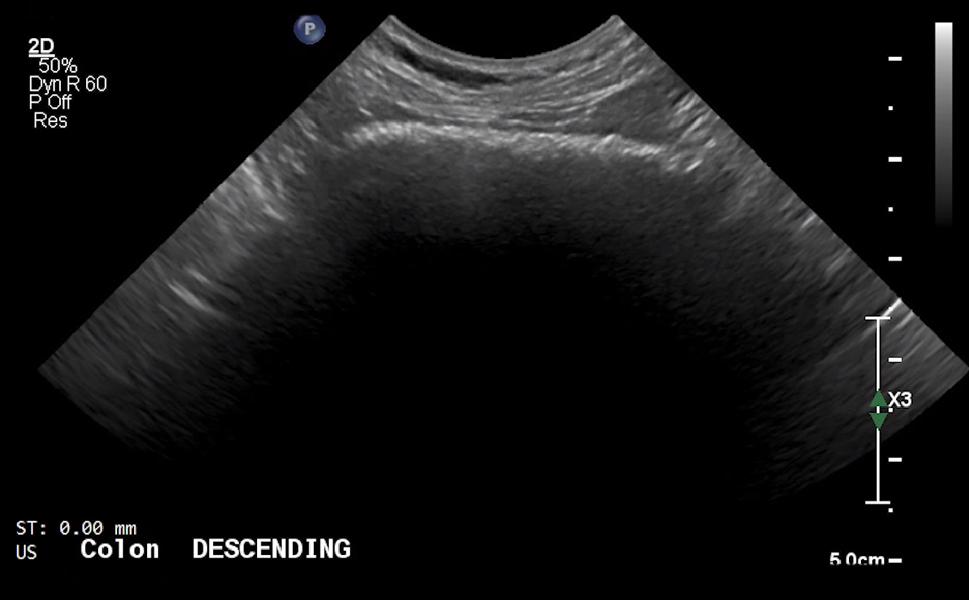 Canine Descending Colon (Long Axis) – NORMAL
