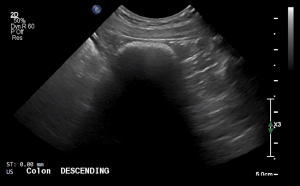 Canine Descending Colon (Short Axis) 1 - NORMAL