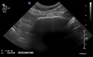 Canine Descending Colon (Short Axis) 2 - NORMAL