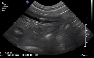 Canine Descending Duodenum (Long Axis) - NORMAL