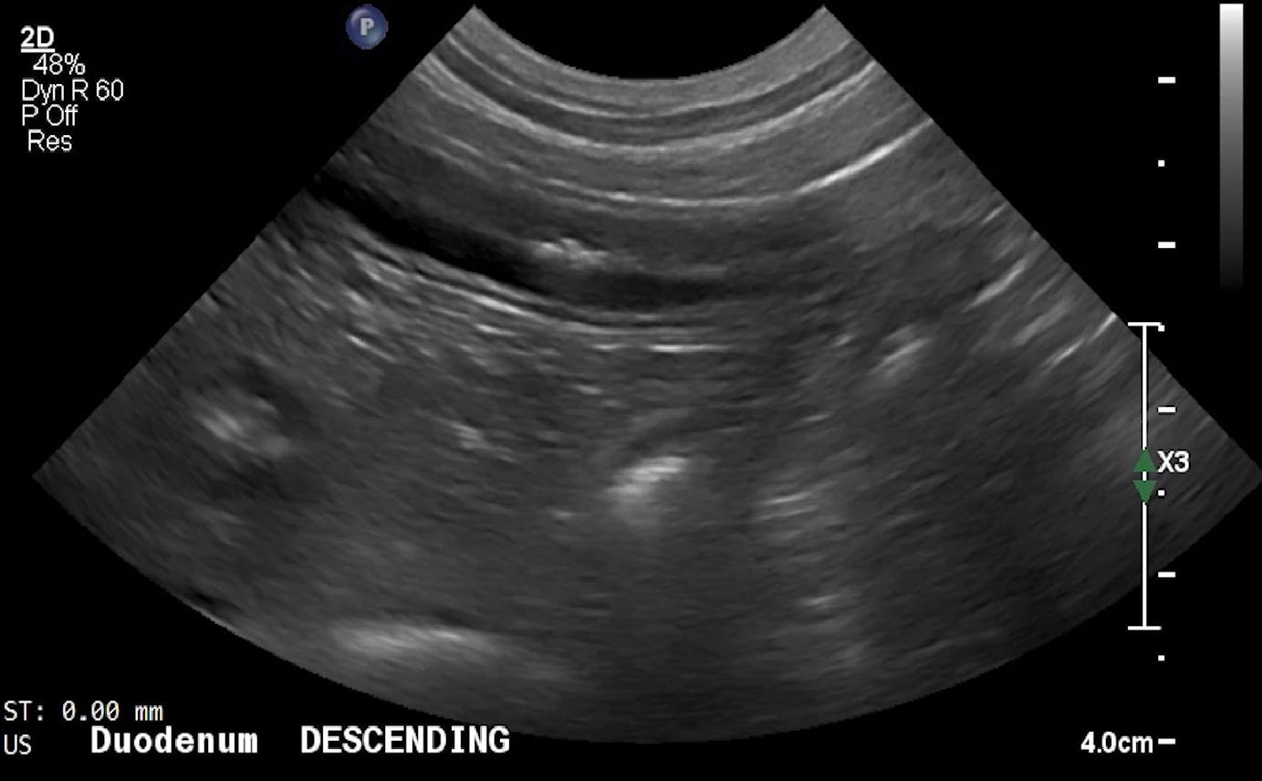 Canine Descending Duodenum (Long Axis) – NORMAL
