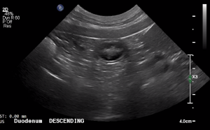 Canine Descending Duodenum (Short Axis) - NORMAL