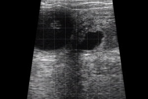 Bovine - Early Pregnancy 2