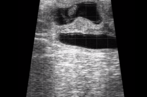Bovine - Early Pregnancy 3