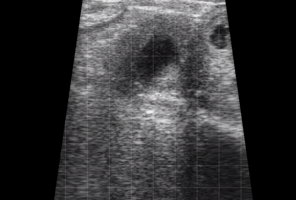 Bovine – Early Pregnancy 1