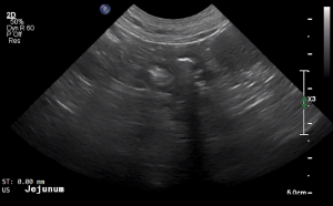 Canine Jejunum (Short Axis) 1 - NORMAL