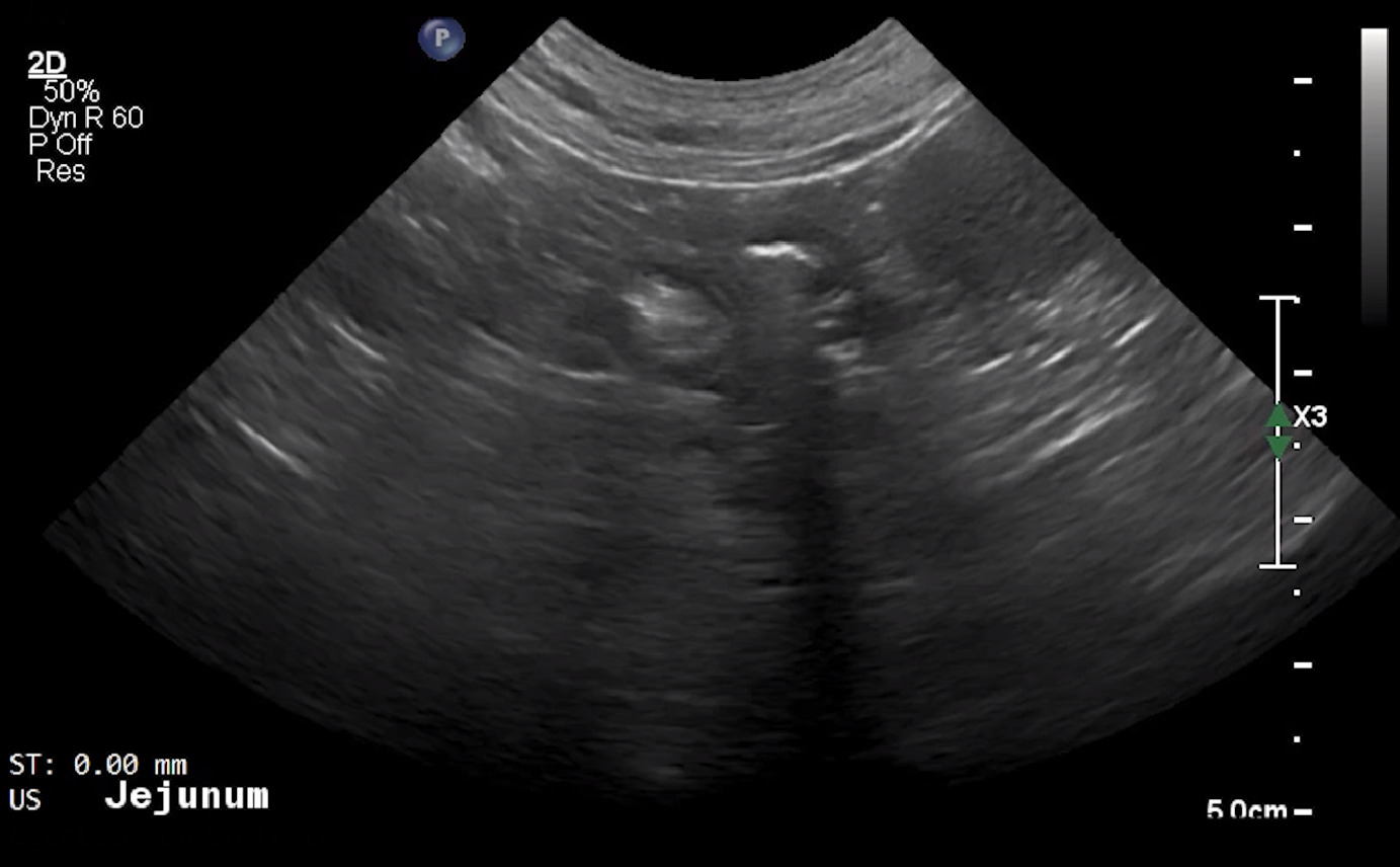 Canine Jejunum (Short Axis) 1 – NORMAL