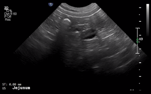 Canine Jejunum (Short Axis) 2 - NORMAL