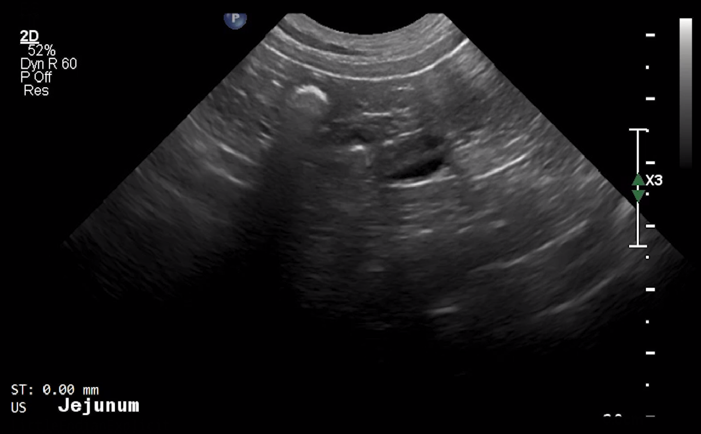 Canine Jejunum (Short Axis) 2 – NORMAL