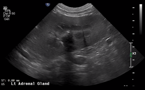 Canine Left Adrenal Gland (Longitudinal) - NORMAL