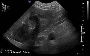 Canine Left Adrenal Gland (Transverse) - NORMAL