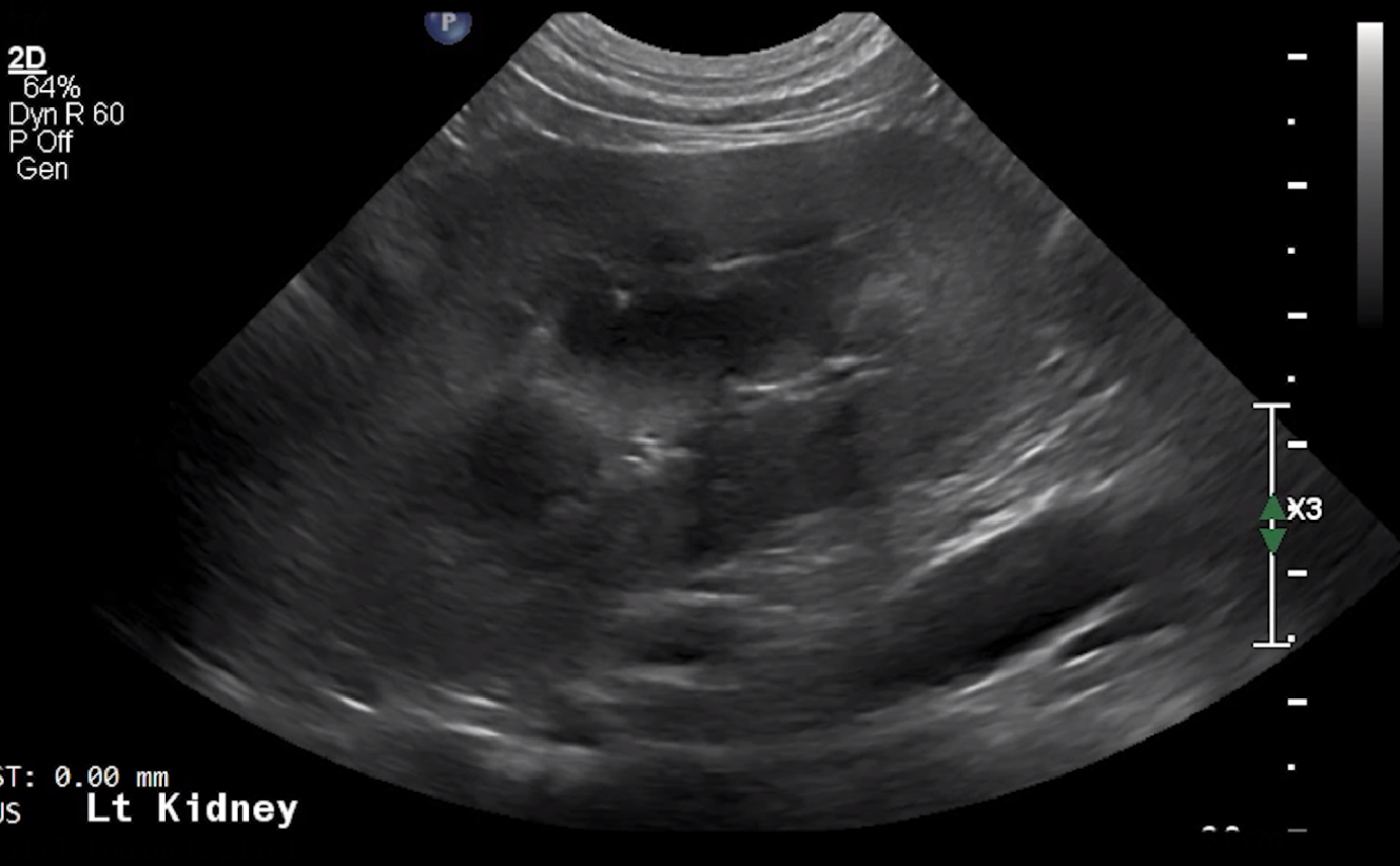 Canine Left Kidney (Longitudinal) – NORMAL