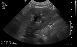 Canine Left Kidney (Transverse) - NORMAL