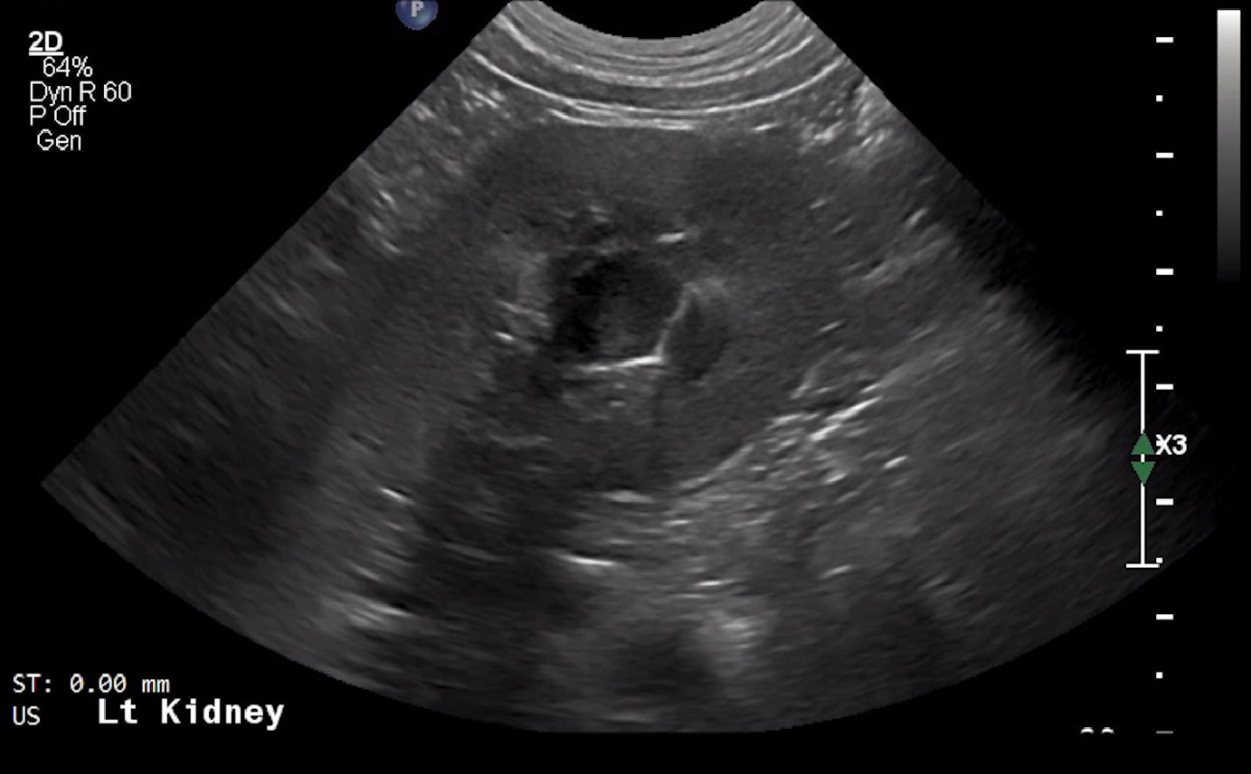 Canine Left Kidney (Transverse) – NORMAL