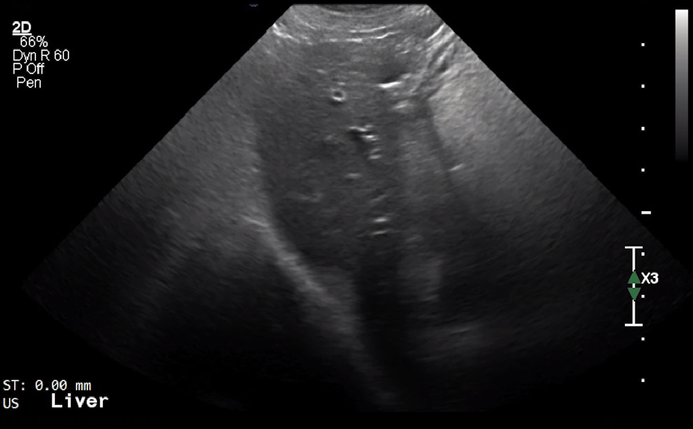 Canine Liver (Sagittal) – NORMAL