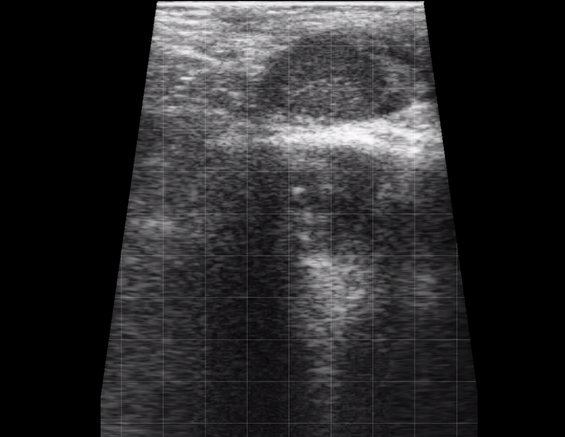Bovine Left Uterine Horn (Normal)