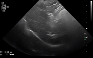 Canine Left Liver (Sagittal) - NORMAL