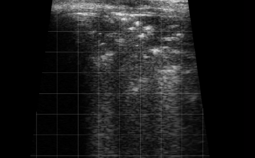 Calf Lung Consolidation 1