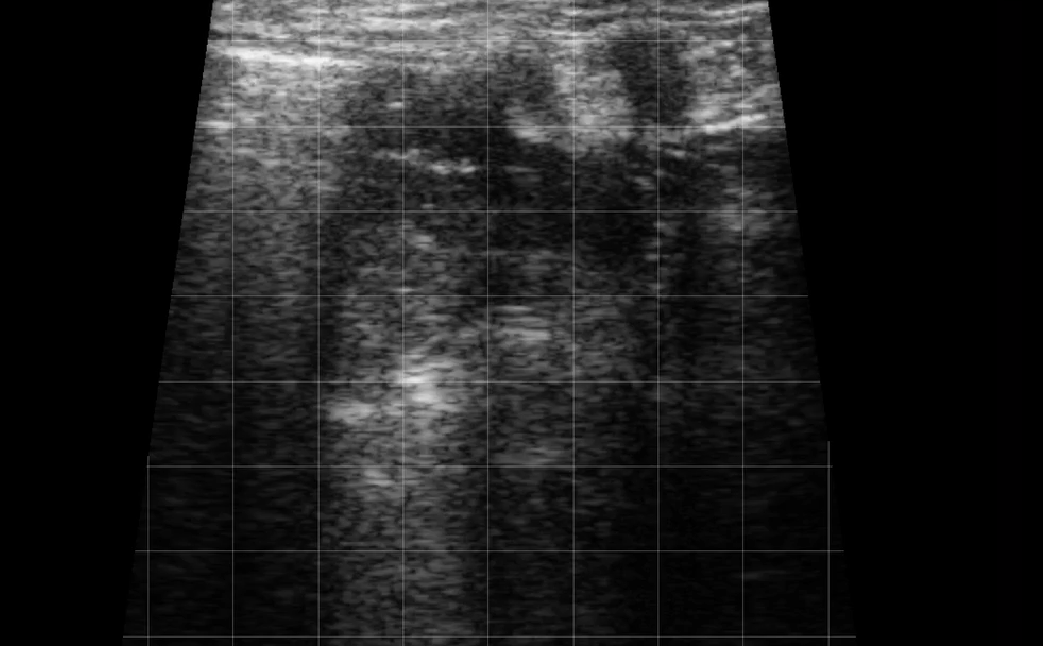 Calf Lung Consolidation 2
