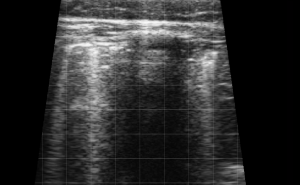 Calf Lung Consolidation 3
