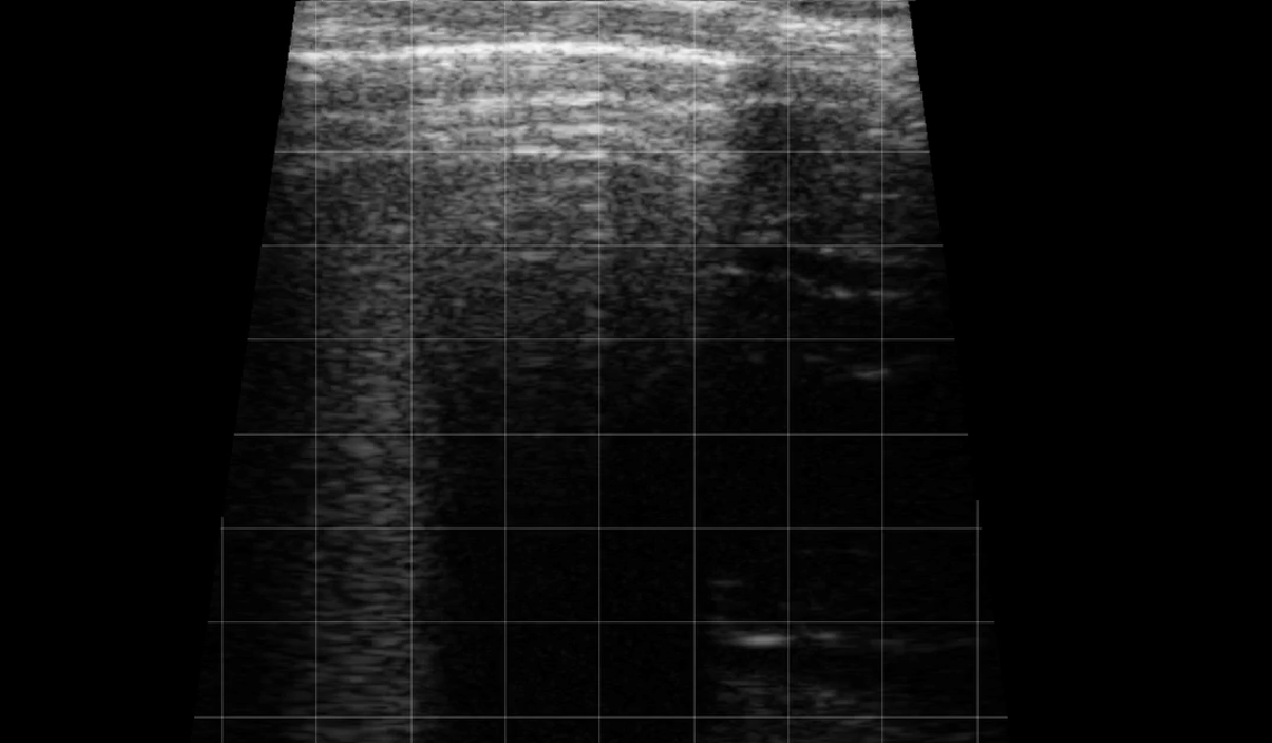 Calf Lung Rockets 1