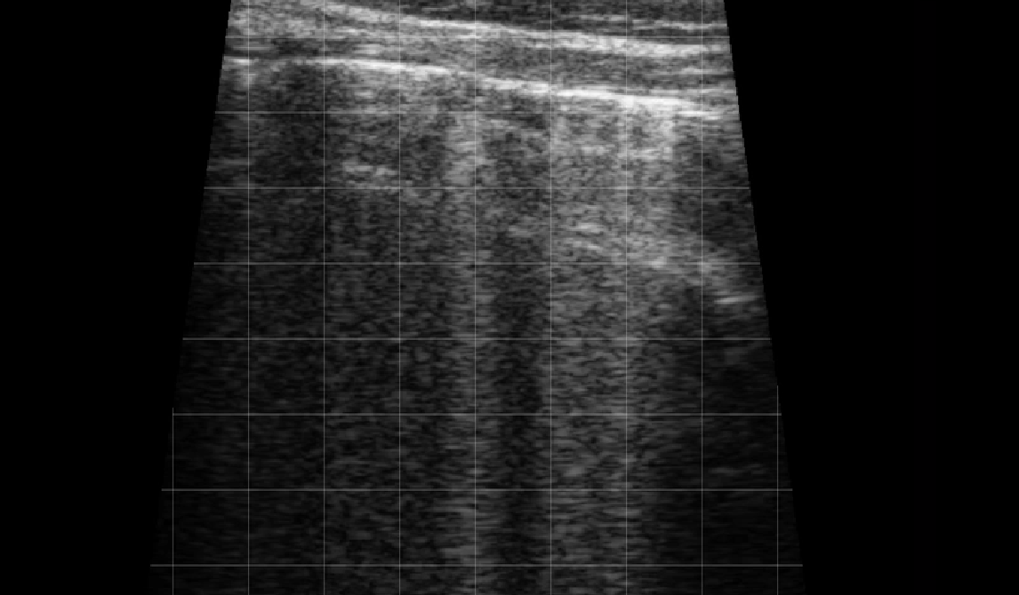 Calf Lung Rockets 2