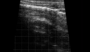 Calf Lung Rockets 3
