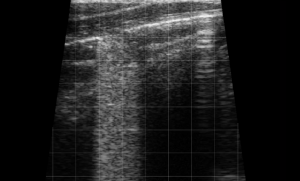 Calf Lung Rockets 4