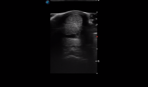 Metacarpal Region 1A (Transverse)