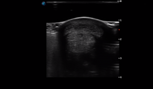 Metacarpal Region 3B (Transverse) 2