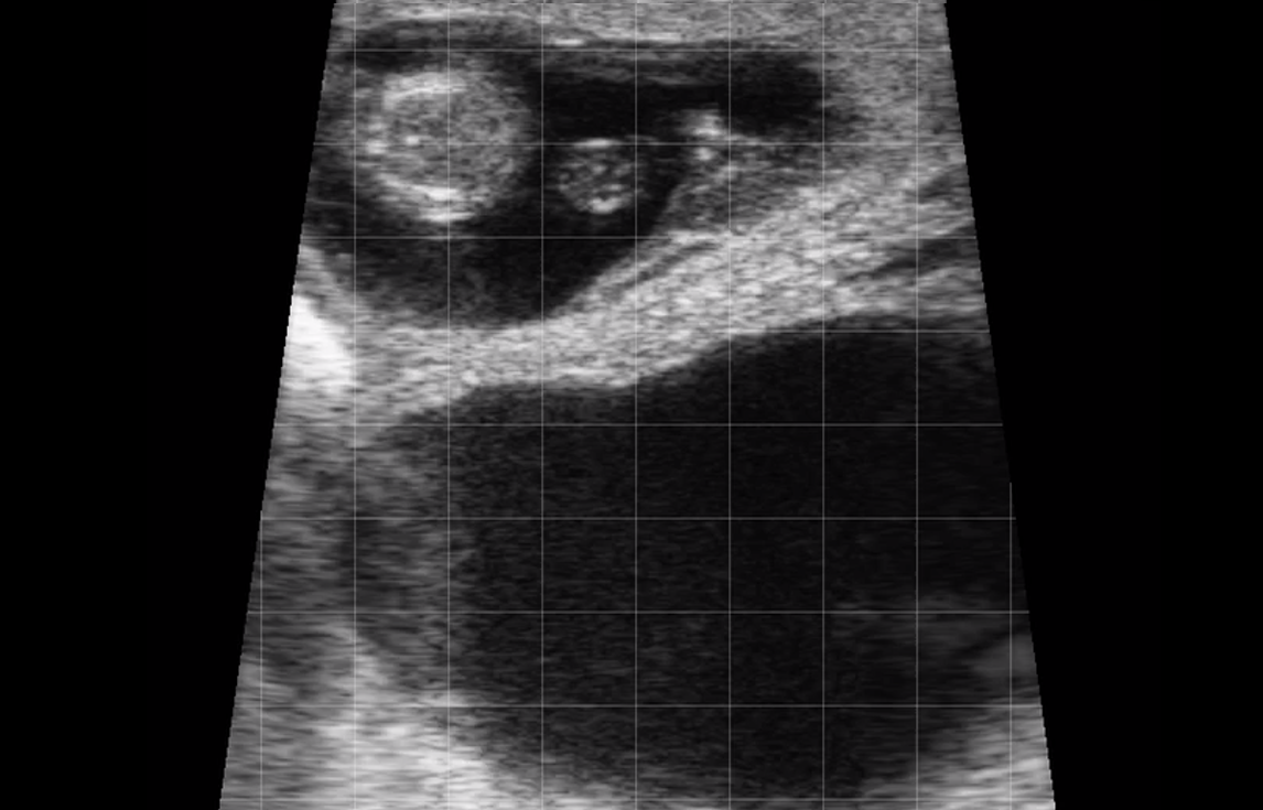 Bovine – Mid Pregnancy