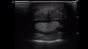 Forelimb Pastern Region P1 (Transverse)
