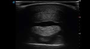 Forelimb Pastern Region P2 (Transverse)