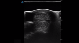 Forelimb Pastern Region P3 (Transverse)