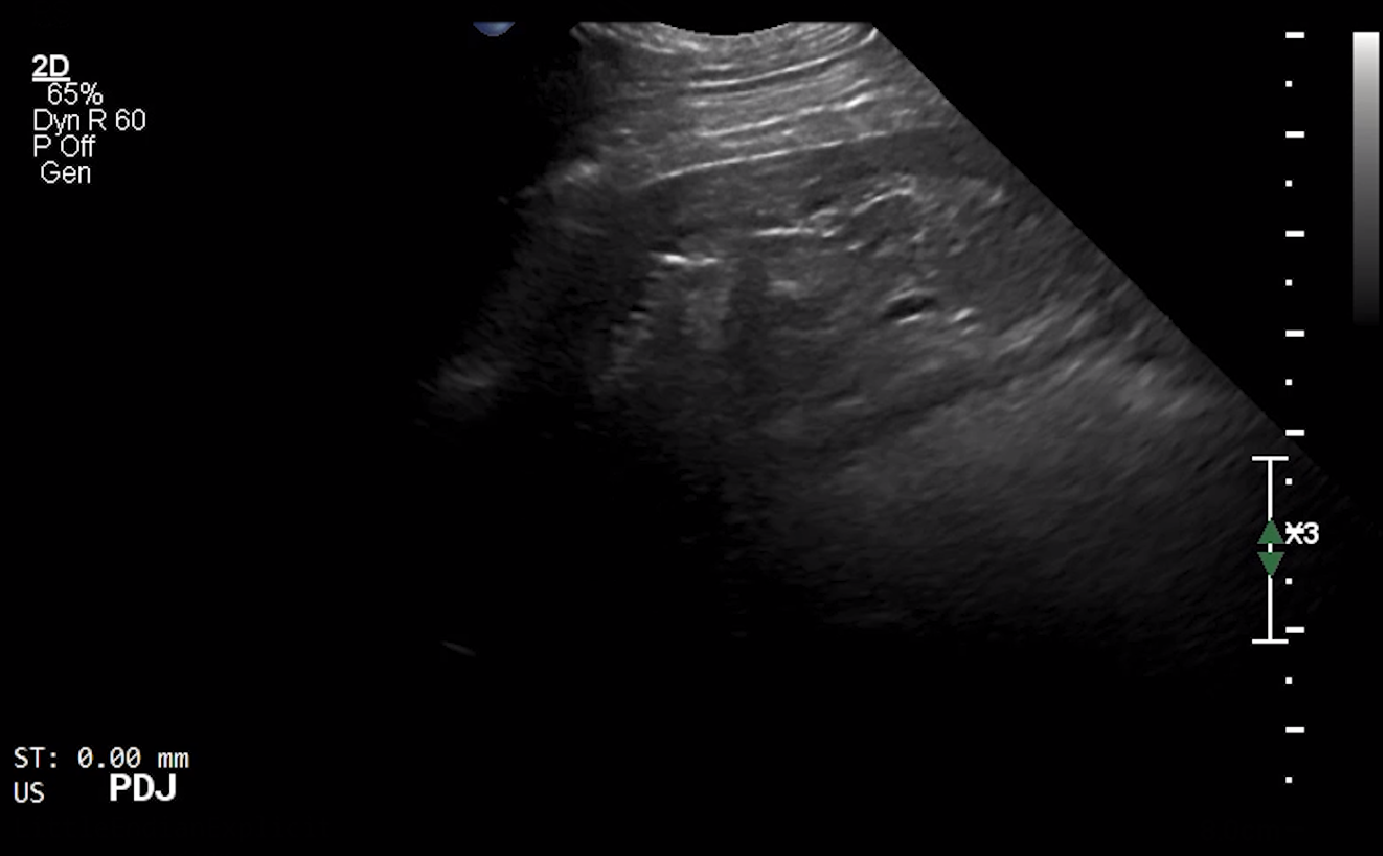 Canine PDJ (Longitudinal) – NORMAL