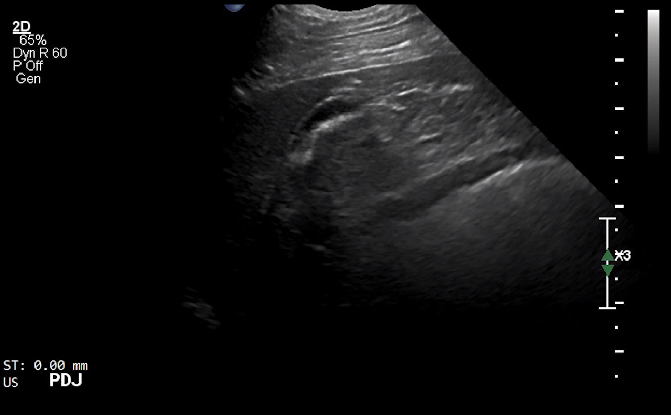 Canine PDJ (Longitudinal + Intercostal) – NORMAL