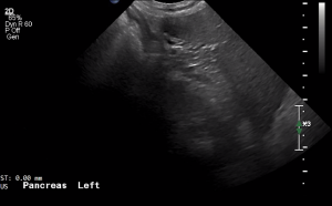 Canine Pancreas (Left Limb, Longitudinal) - NORMAL