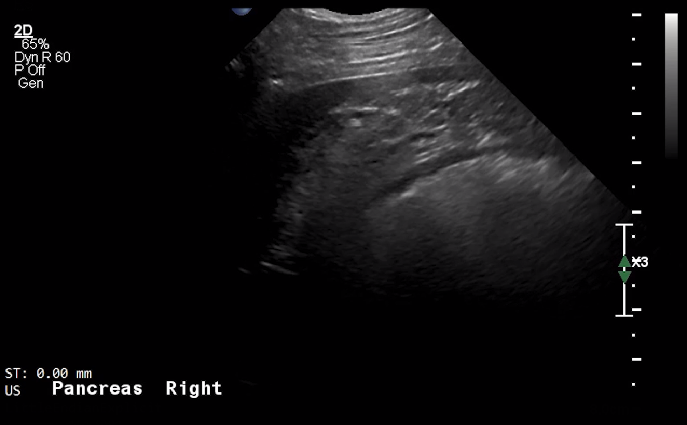 Canine Pancreas (Right Limb, Longitudinal) – NORMAL