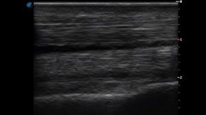 Forelimb Pastern Region (Longitudinal)