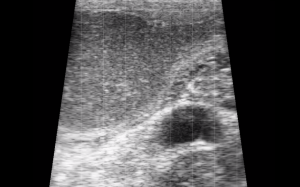 Bovine - Pyometra 2