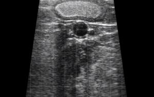 Bovine - Pyometra 1