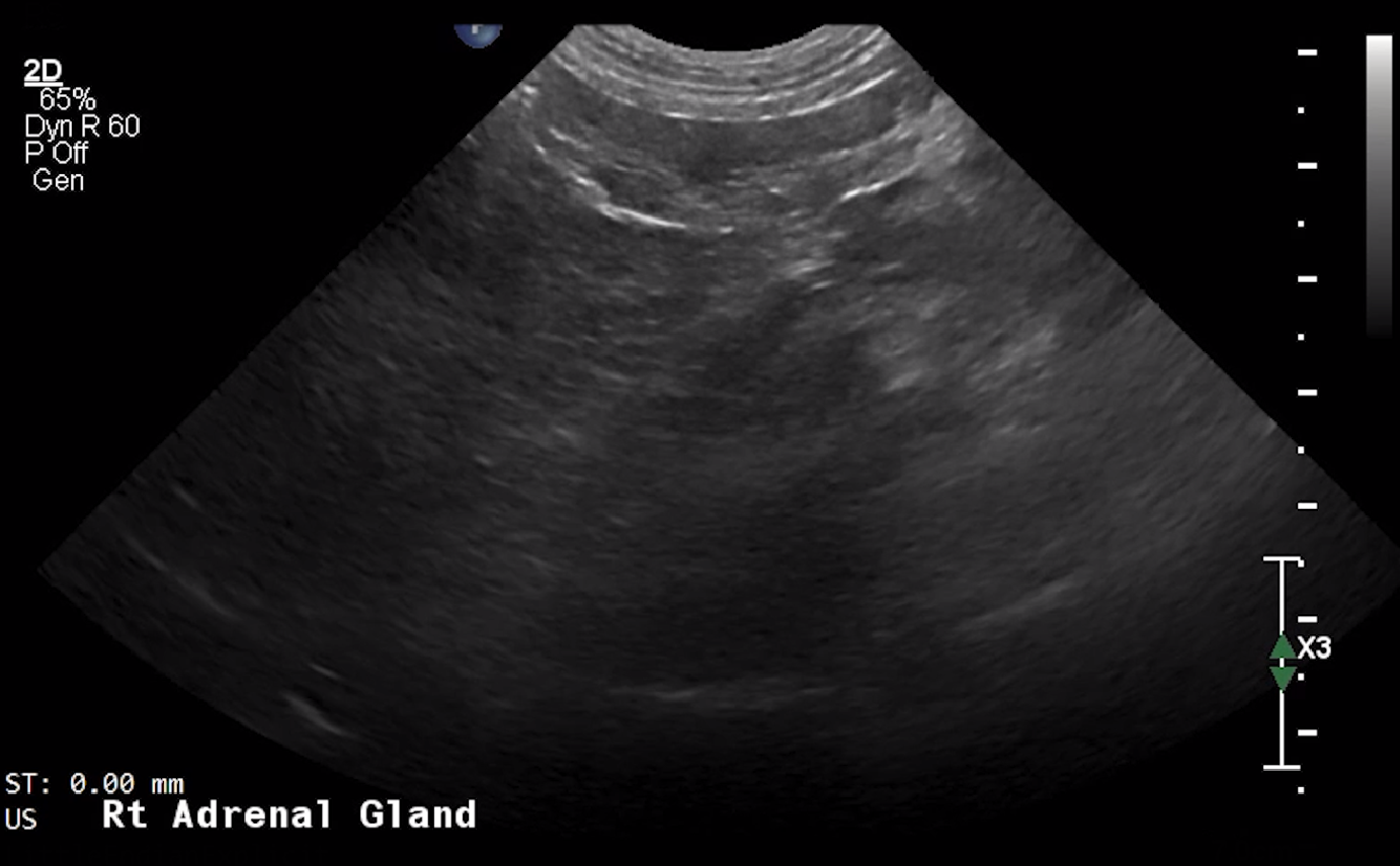 Canine Right Adrenal Gland (Longitudinal) – NORMAL