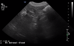 Canine Right Adrenal Gland (Transverse) - NORMAL
